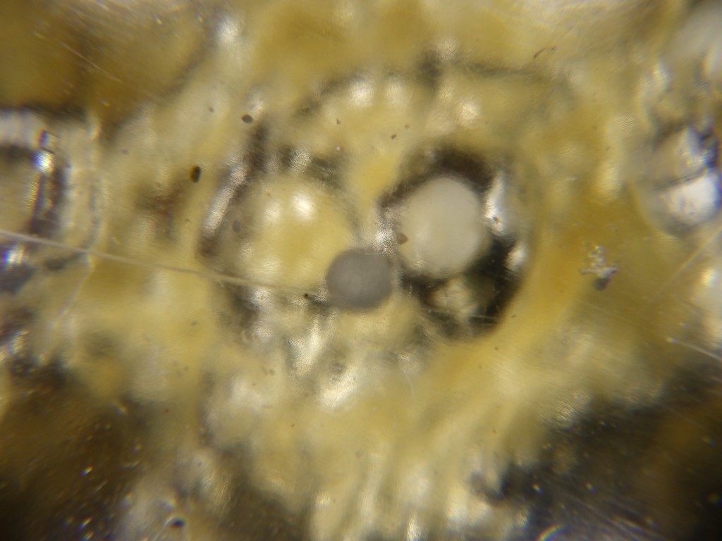 Medallion n'4 — detail